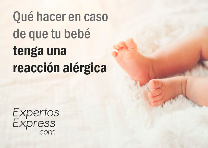 qué hacer con reacción alérgica de tu bebe